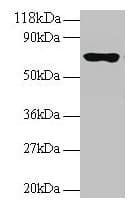 Polyclonal Rabbit anti-Human RPL15 / Ribosomal Protein L15 Antibody (IHC, WB)
