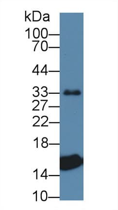 TTR / Transthyretin Antibody (aa21-150)