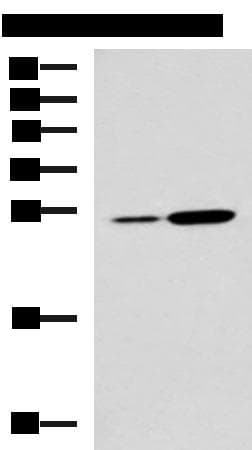 NQO2 Antibody