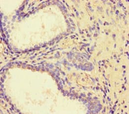 Polyclonal Rabbit anti-Human PDLIM5 / LIM Antibody (IHC, IF)