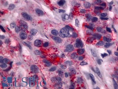 IHC-plus™ ADGRG1 / GPR56 Antibody (Cytoplasmic Domain)