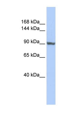 Polyclonal Rabbit anti-Human TNNI3K / CARK Antibody (aa755-804, WB)