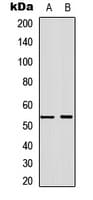 IHC-plus™ ANXA7 / Annexin VII / SNX Antibody (Internal)
