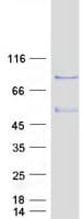 Human ZSWIM3 Protein (Recombinant Myc-DDK (Flag))