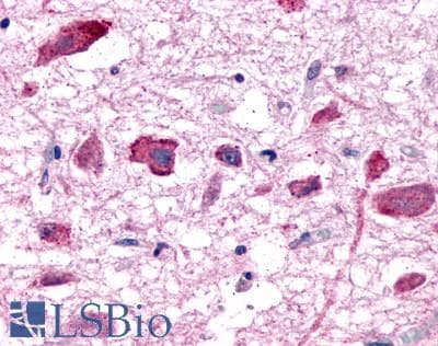 PathPlus™ Polyclonal Rabbit anti-Human PGR1 / GPR153 Antibody (C-Terminus, IHC)