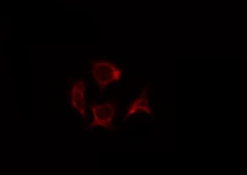 Polyclonal Rabbit anti-Human SOCS2 Antibody (IF, WB)