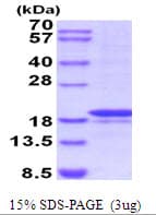 Human MMP7 / Matrilysin Protein (Recombinant His)