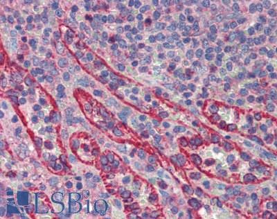 EPO / Erythropoietin Antibody (aa28-192)