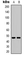 HTR2C / 5-HT2C Receptor Antibody (Internal)