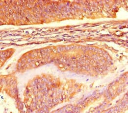 ME2 / Malate Dehydrogenase 2 Antibody