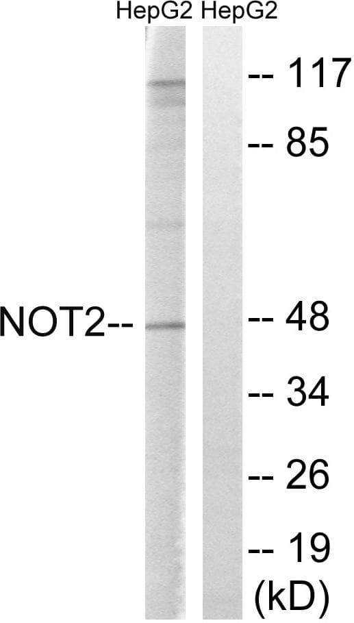 CNOT2 Antibody (p101)