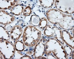 Monoclonal Mouse anti-Human RIP1 / RALBP1 Antibody (clone OTI1E2, IHC, IF, WB)