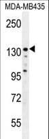 ZEB2 / SIP-1 Antibody (aa1078-1105)