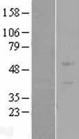 ZNF669 Protein (Over-Expression Lysate Myc-DDK (Flag))