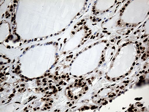 Monoclonal Mouse anti-Human PTBP3 / ROD1 Antibody (clone OTI5G7, aa300-552, IHC, WB)