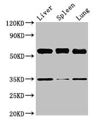 GBA / Glucosidase Beta Acid Antibody