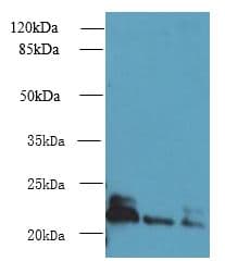 Polyclonal Rabbit anti-Human ARL8A + ARL8B Antibody (IHC, WB)