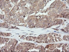 MAP2K3 / MEK3 / MKK3 Antibody (clone OTI4B3)