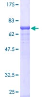 Human HYAL3 Protein (Recombinant GST)