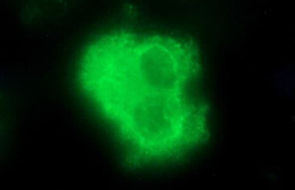 SCAMP2 Antibody (clone OTI2F1)