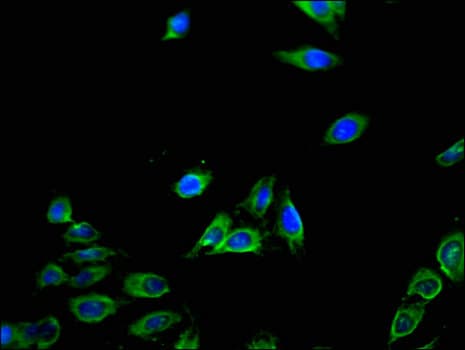 Polyclonal Rabbit anti-Human CXCL11 Antibody (IHC, IF)
