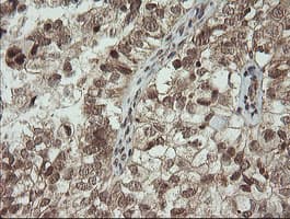 PIK3CG / PI3K Gamma Antibody (clone OTI1A9)