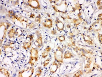 Polyclonal Rabbit anti-Human LOXL1 Antibody (IHC, WB)