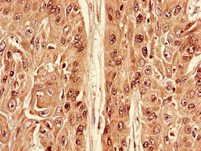 Polyclonal Rabbit anti-Human Apg7 / ATG7 Antibody