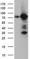 IHC-plus™ ARHGAP25 Antibody (clone 12G4)