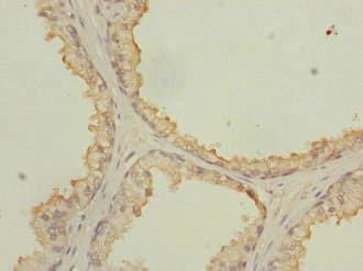 NMT2 Antibody