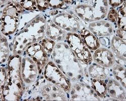 GBE1 Antibody (clone OTI3B4)