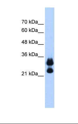 Polyclonal Rabbit anti-Human HIST1H1C Antibody (aa101-150, IHC, WB)