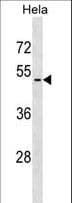 Polyclonal Rabbit anti-Human VPAC2 / VIPR2 Antibody (aa95-123, WB)
