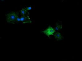 KLK8 / Kallikrein 8 Antibody (clone OTI2C6)