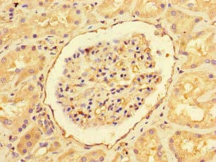 Polyclonal Rabbit anti-Human EHD3 Antibody (IHC, IF)