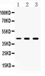 HIV-1 tat Antibody