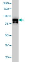 Monoclonal Mouse anti-Human DYRK / DYRK1A Antibody (clone 7D10, WB)