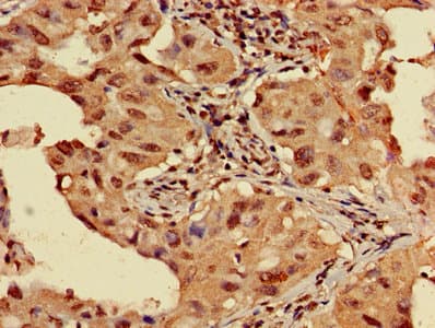 HIST1H3A Antibody