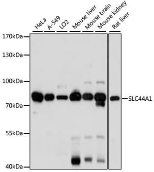 Polyclonal Rabbit anti-Human SLC44A1 / CD92 Antibody (WB)