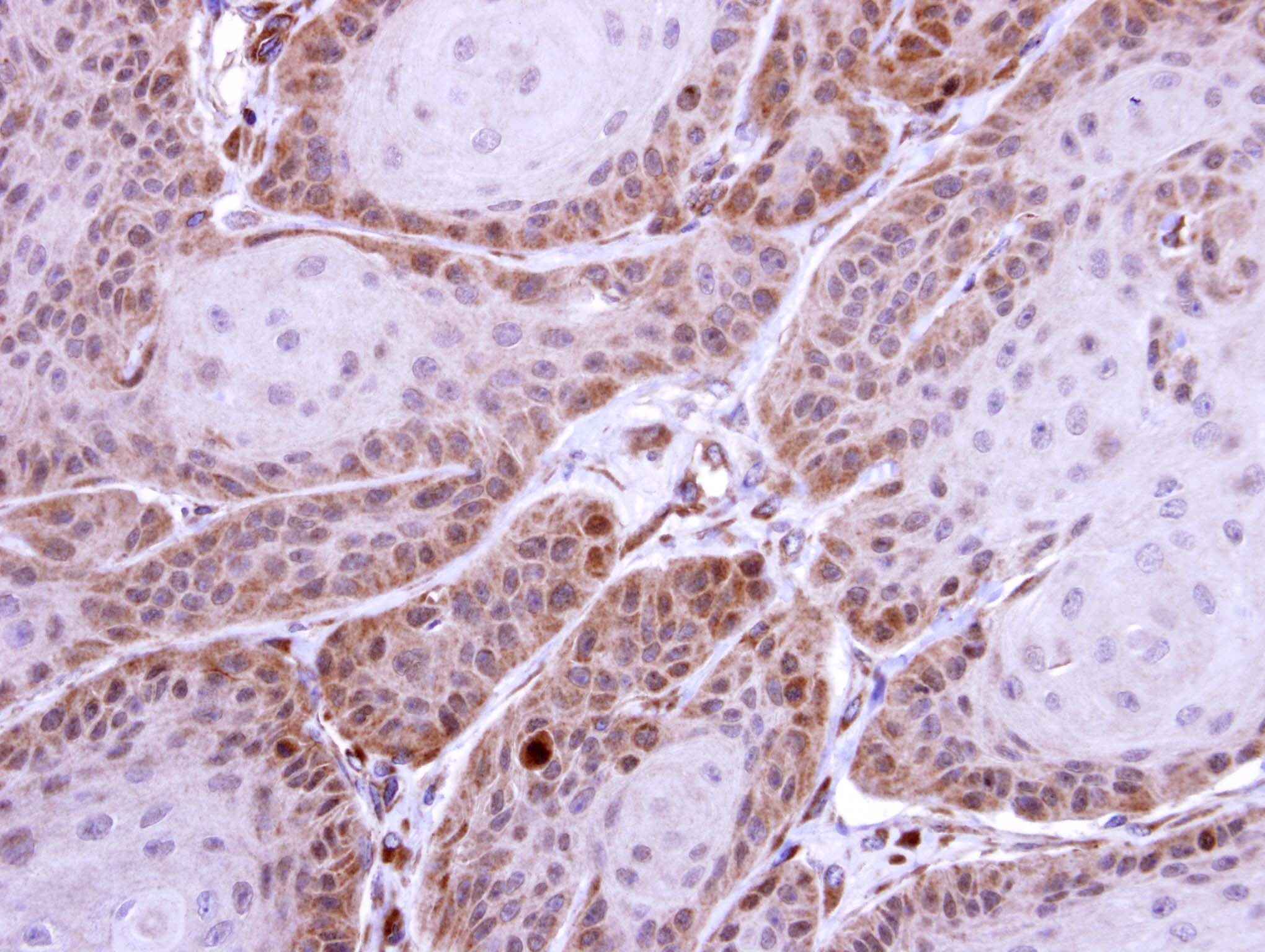 HS1BP3 Antibody (aa320-392)