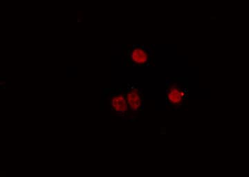 Polyclonal Rabbit anti-Human MYF5 / MYF 5 Antibody (IF, WB)