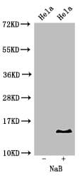 HIST1H2BB Antibody