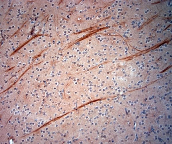 NEFH / NF-H Antibody (aa150-200)