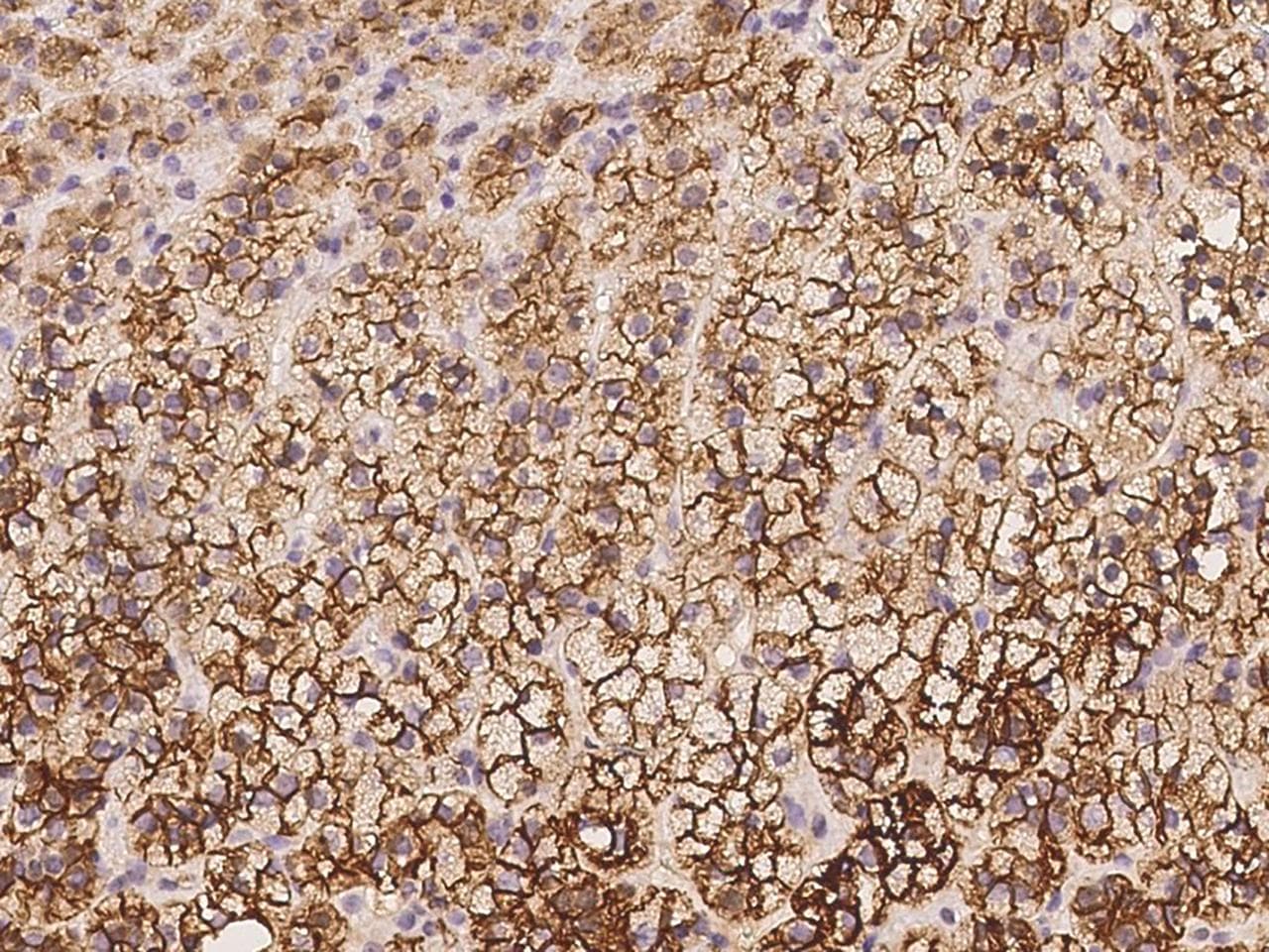 ABCC3 / MRP3 Antibody
