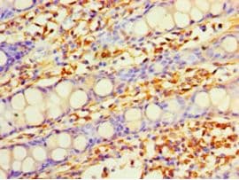 DHRS7 Antibody (aa29-339)