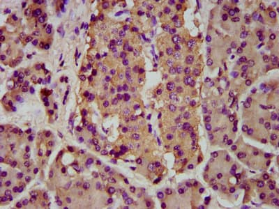 Polyclonal Rabbit anti-Human BMPER Antibody (IHC)