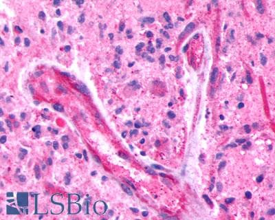 PathPlus™ Polyclonal Rabbit anti-Human ADGRB3 / BAI3 Antibody (Cytoplasmic Domain, IHC)