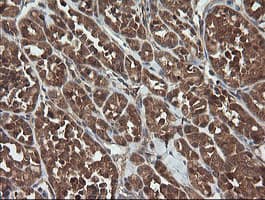 Monoclonal Mouse anti-Human TRAPPC4 / Synbindin Antibody (clone OTI2G8, IHC, WB)