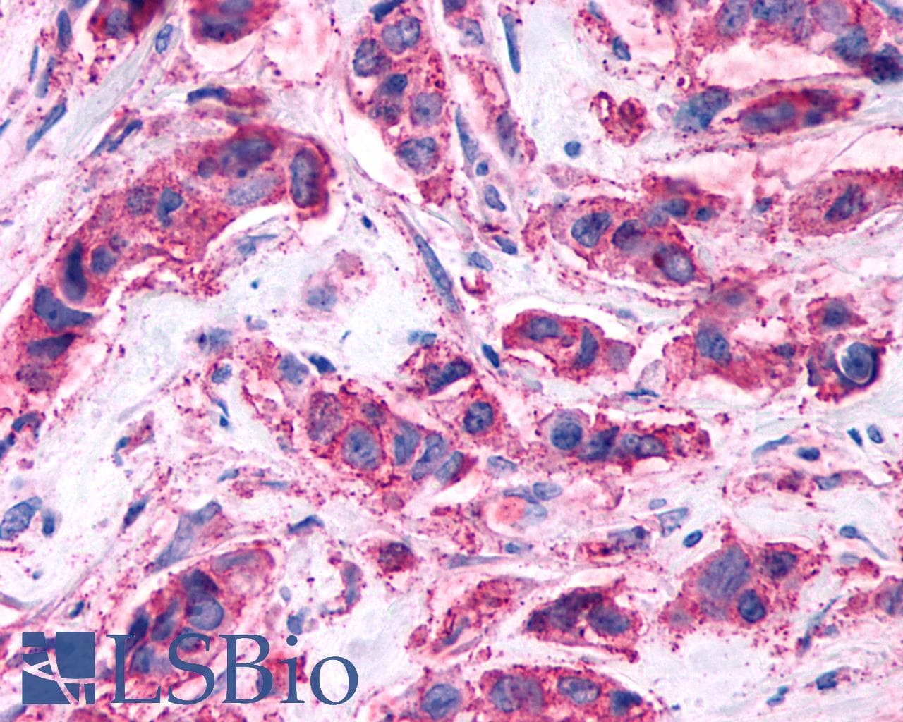 PathPlus™ Polyclonal Rabbit anti-Human GPR146 Antibody (C-Terminus, IHC)