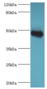 Polyclonal Rabbit anti-Human GATM / AGAT Antibody (aa124-423, IHC, WB)